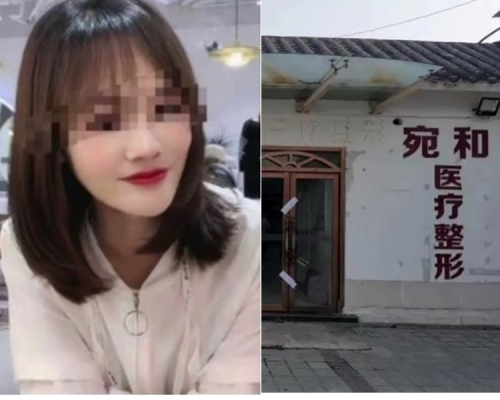 女子整形失敗死亡,驗屍檢報告顯示死因為脂肪栓塞、急性呼吸衰竭。(網圖)