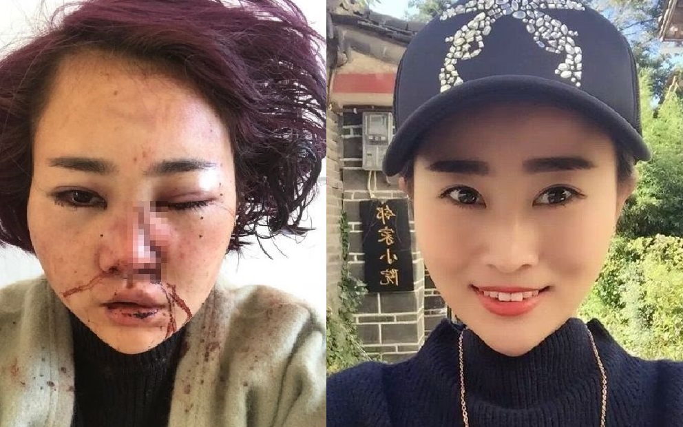 原本相貌娟秀的她，難以面對。