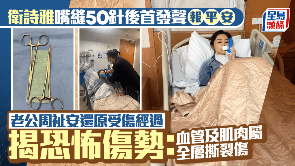 衛詩雅嘴縫50針後首發聲報平安   老公周祉安還原受傷經過揭恐怖傷勢：血管及肌肉屬全層撕裂傷