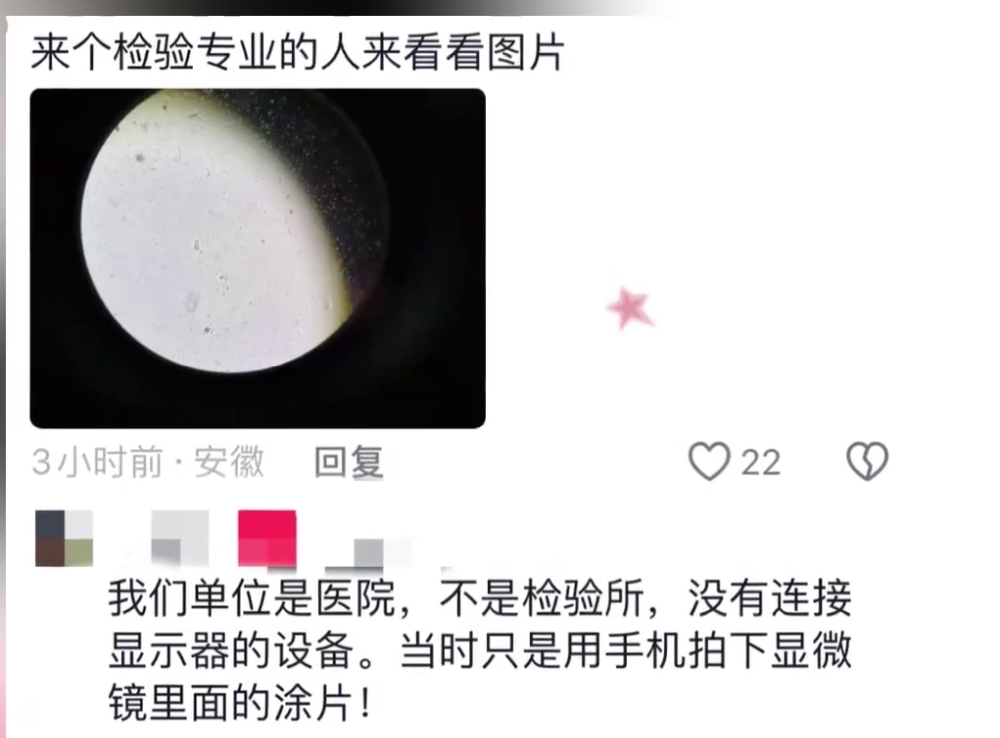 网民称用显微镜睇到有红细胞。