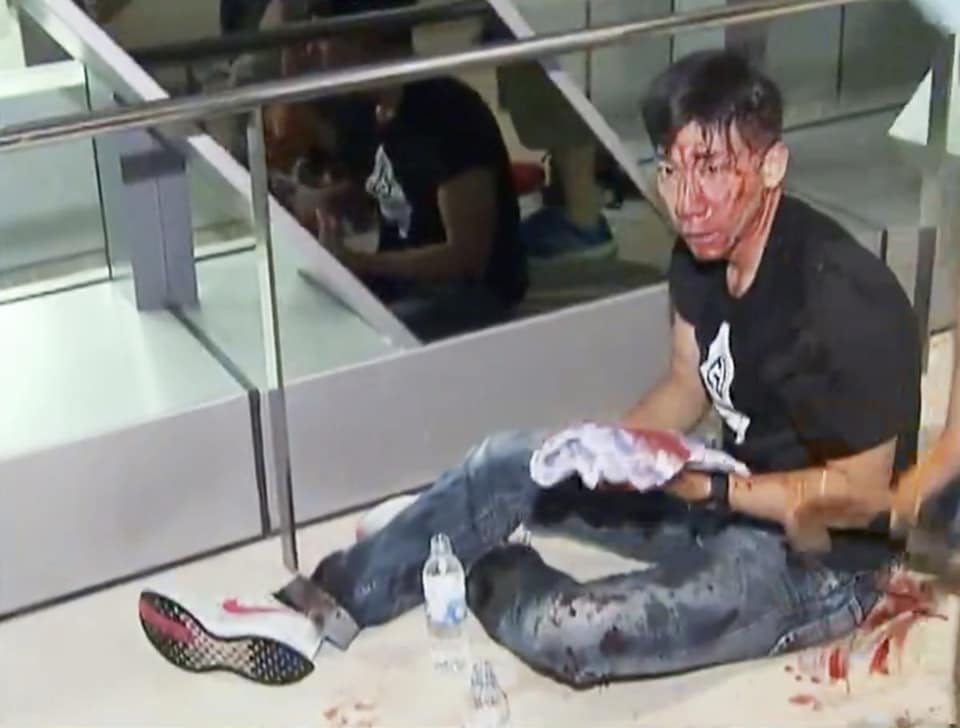 柳俊江在721事件中遇襲受傷，血流披面。網上圖片