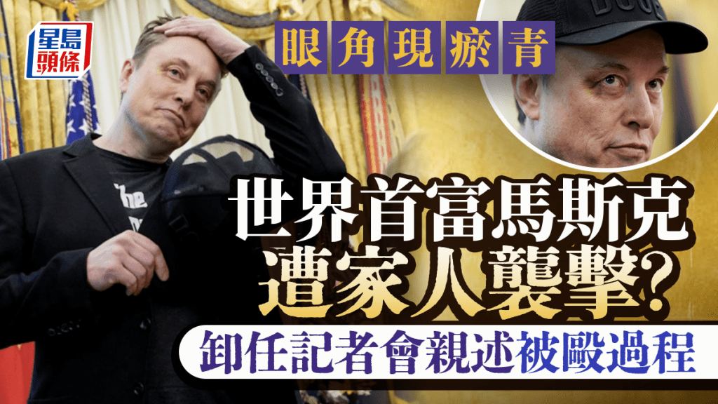 馬斯克眼角現瘀青  變卸任記者會焦點  親揭「被毆」之謎