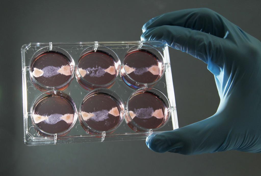 培养肉通过在实验室培育动物细胞制成。