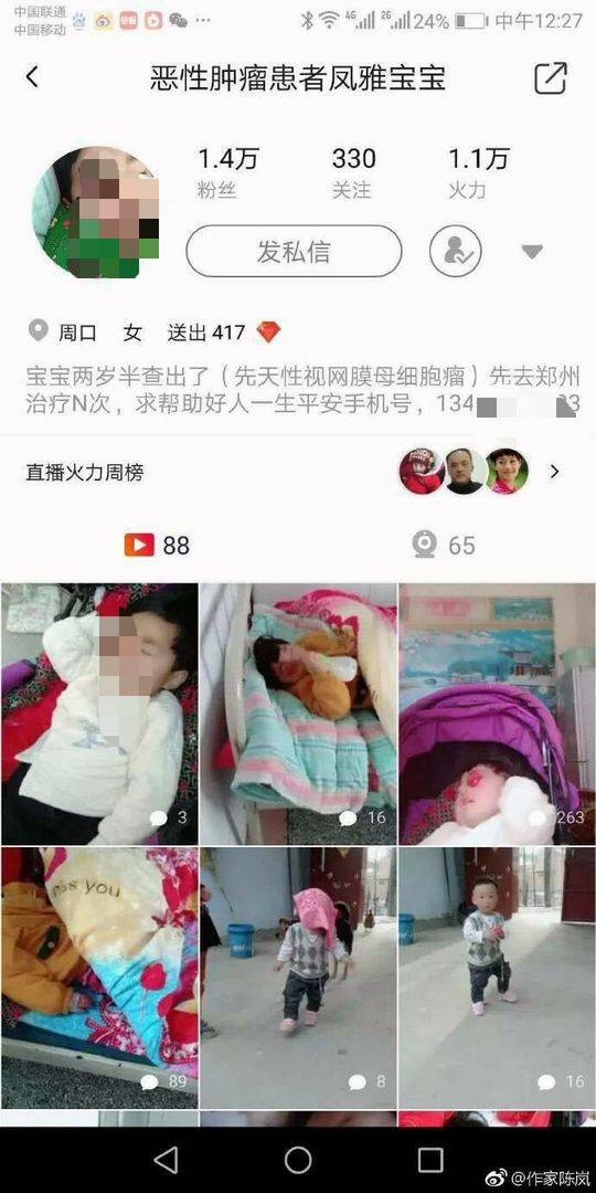夫婦在社交網絡上為３歲患眼癌女兒發起籌款。（網圖）