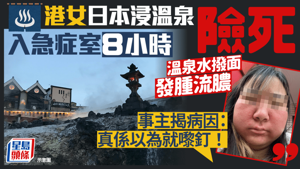 港女日本浸溫泉險死入急症室8小時 溫泉水撥面發腫流膿 事主揭病因：真係以為就嚟釘