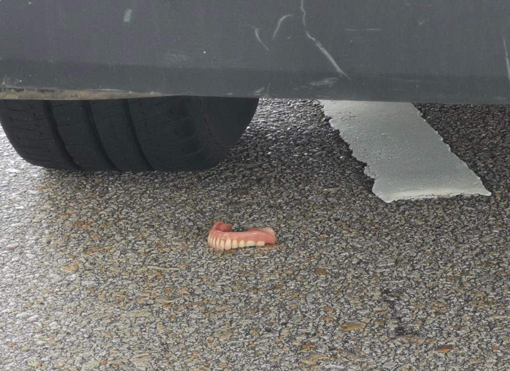 车底遗下半副假牙。