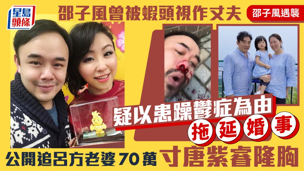 邵子風遇襲｜曾被蝦頭視作丈夫  疑以患躁鬱症為由拖延婚事  公開追呂方老婆70萬寸唐紫睿隆胸