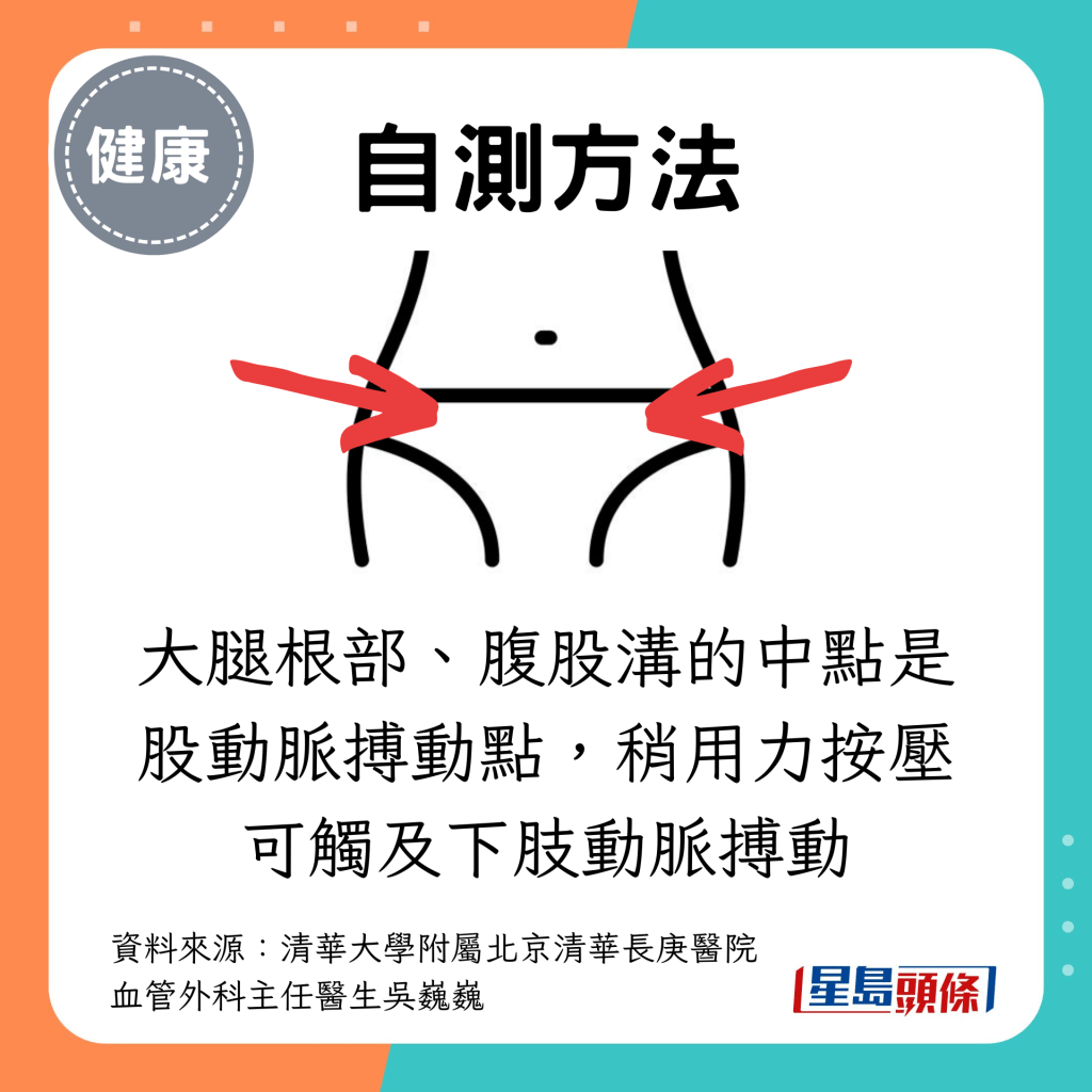 大腿根部、腹股沟的中点是股动脉搏动点，稍用力按压可触及下肢动脉搏动