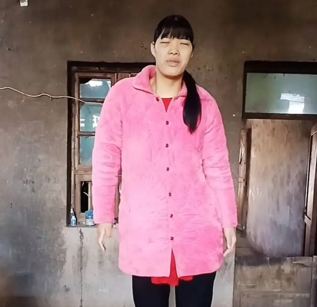 湖南女巨人小莫剛踏入23歲即因病離世，父親更拒絕領取她的骨灰。微博