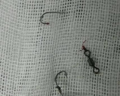 男子吞下2個魚鈎。網上圖片