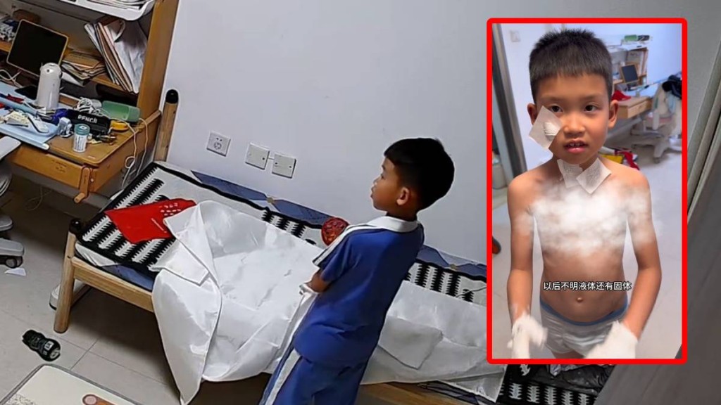 「蟲蟲」好奇打開滅火毯，致全身刺滿玻璃纖維，又痕又痛。抖音