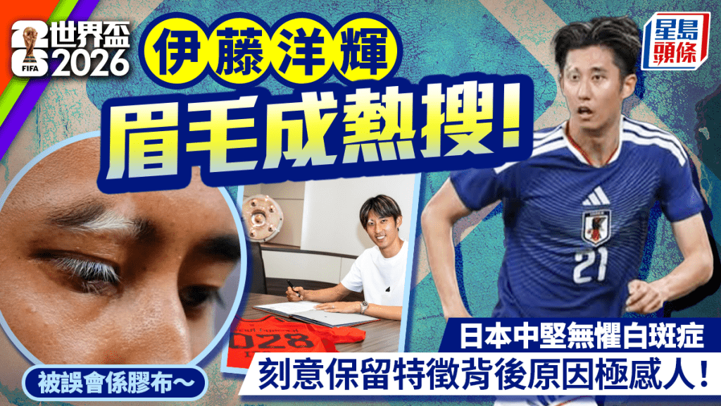 世界盃2026｜伊藤洋輝眉毛成熱搜！日本中堅無懼白斑症 刻意保留特徵背後原因極感人！