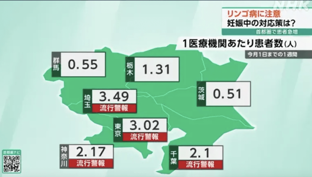 截至12月1日的一周内，东京都264间医疗机构通报的「传染性红斑」个案达796人，刷新自1999年开始统计以来的最高纪录。