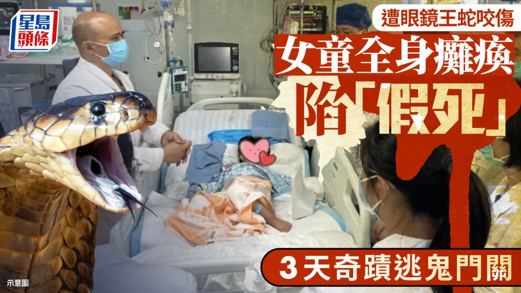 3歲女童被眼鏡王蛇咬傷全身癱瘓 「假死」3天逃鬼門關