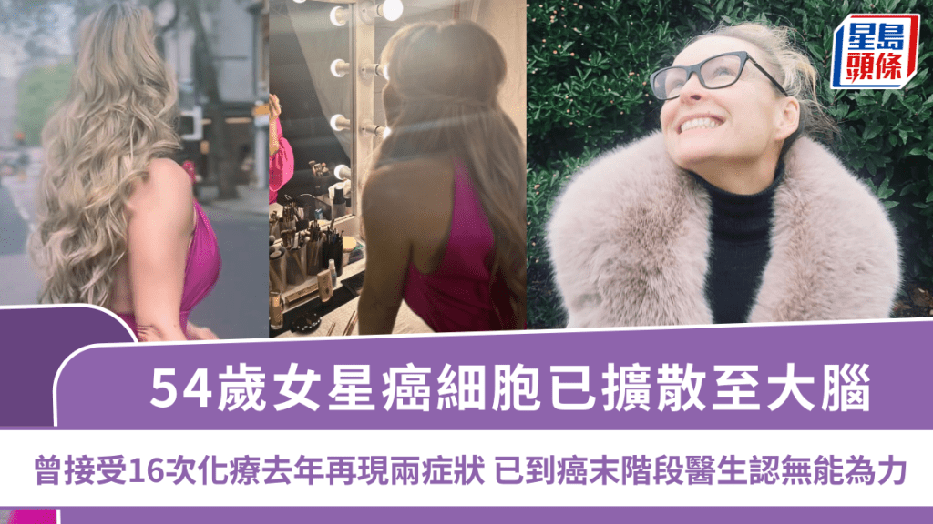 54歲女星癌細胞已擴散至大腦  曾接受16次化療去年再現兩症狀  已到癌末階段醫生認無能為力