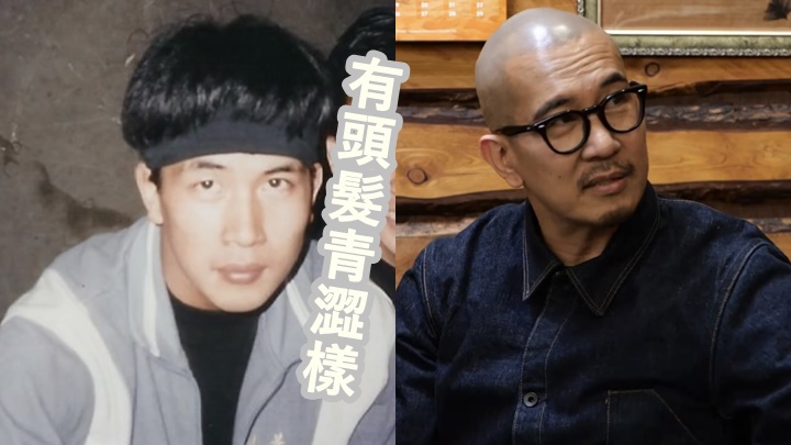 具俊曄自言從25歲開始便有脫髮徵兆。