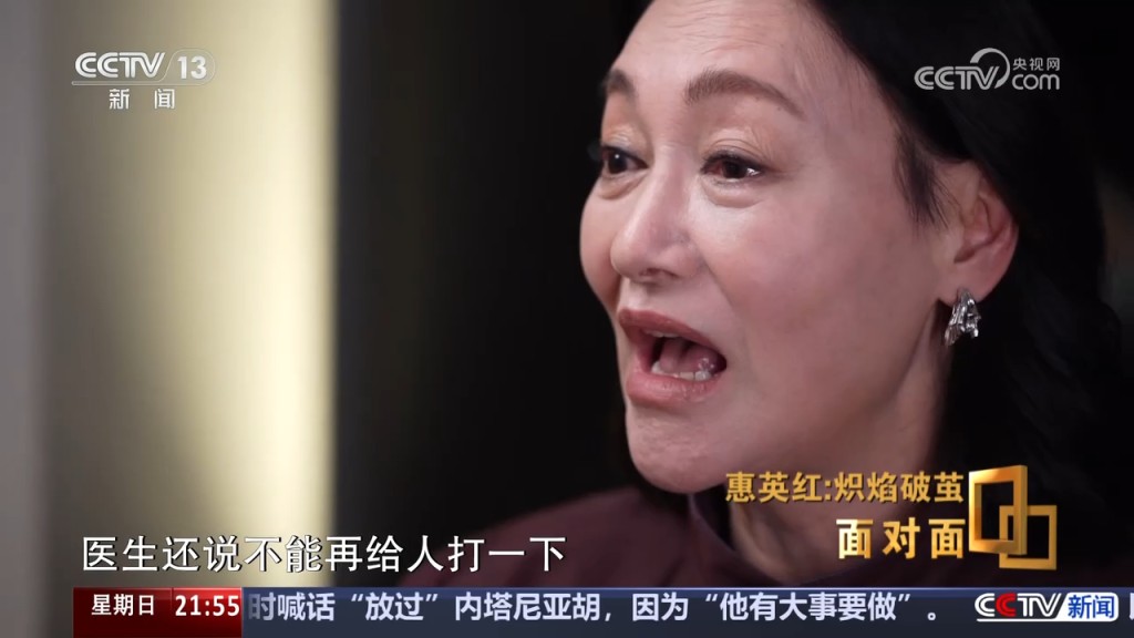 惠英紅憶述當時醫生指，如果她的臉書再被人打一下，眼珠都可能會掉下來。