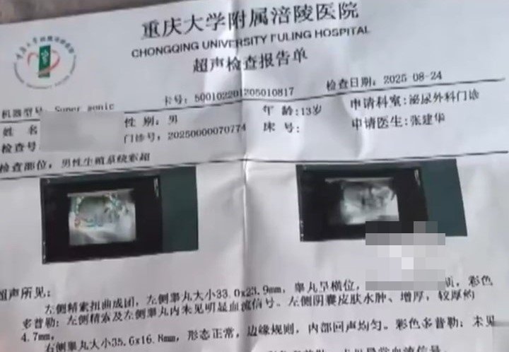 小錢的檢查報告。重慶網絡廣播電視台