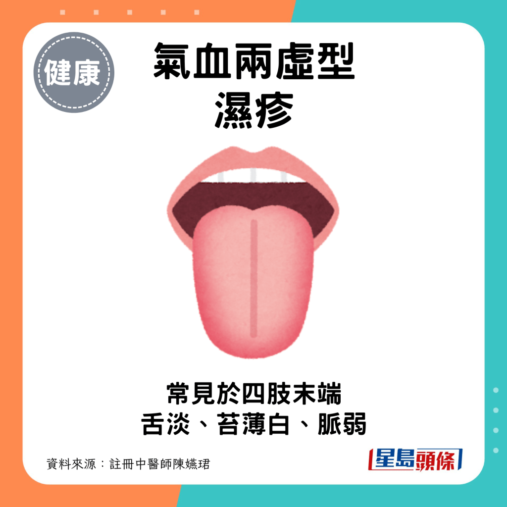 气血两虚型湿疹：舌淡，苔薄白，脉弱。