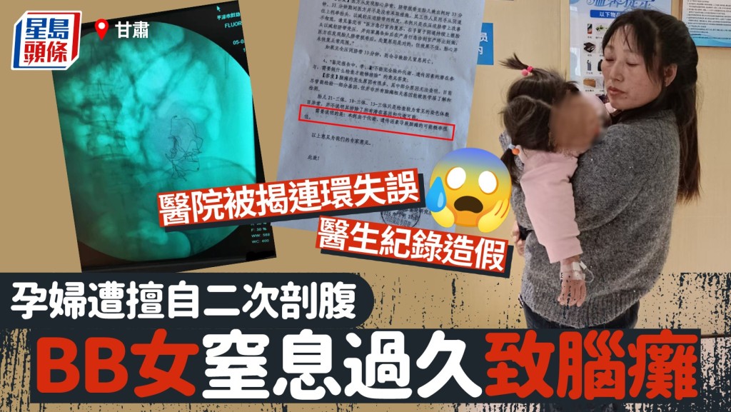 甘肅婦遭擅自二次剖腹致女腦癱  揭醫院連環失誤醫生紀錄造假