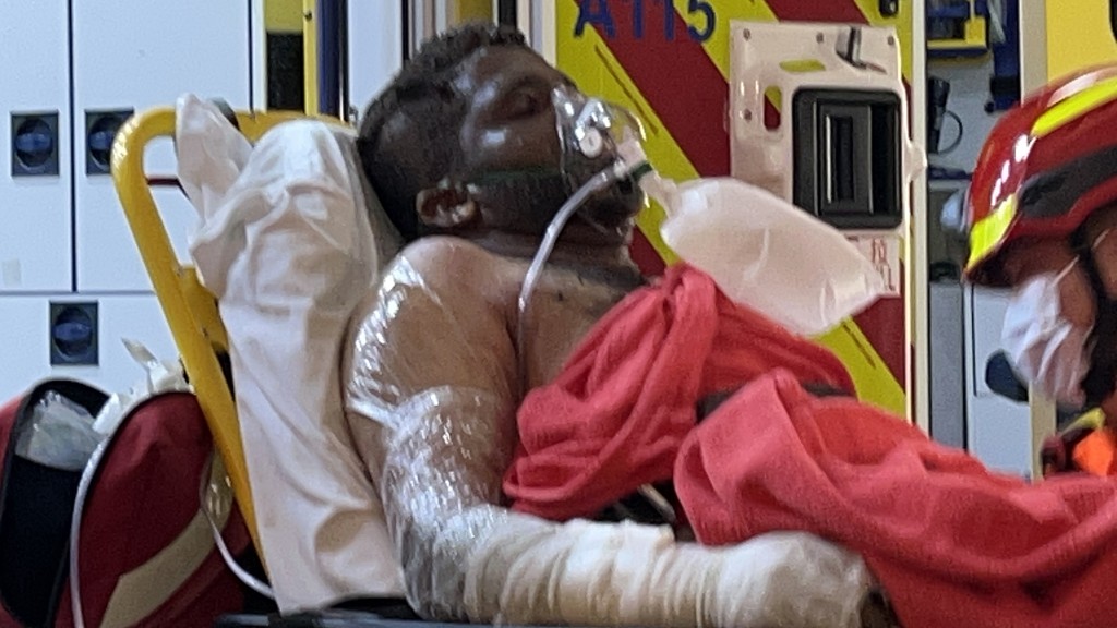 一名南亞裔男工燒傷送院。蔡楚輝攝 一名南亞裔男工燒傷送院。蔡楚輝攝