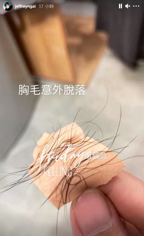 胸毛意外脫落。