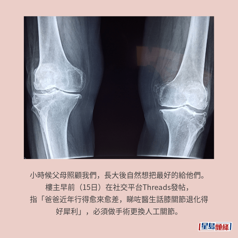 示意圖 示意圖