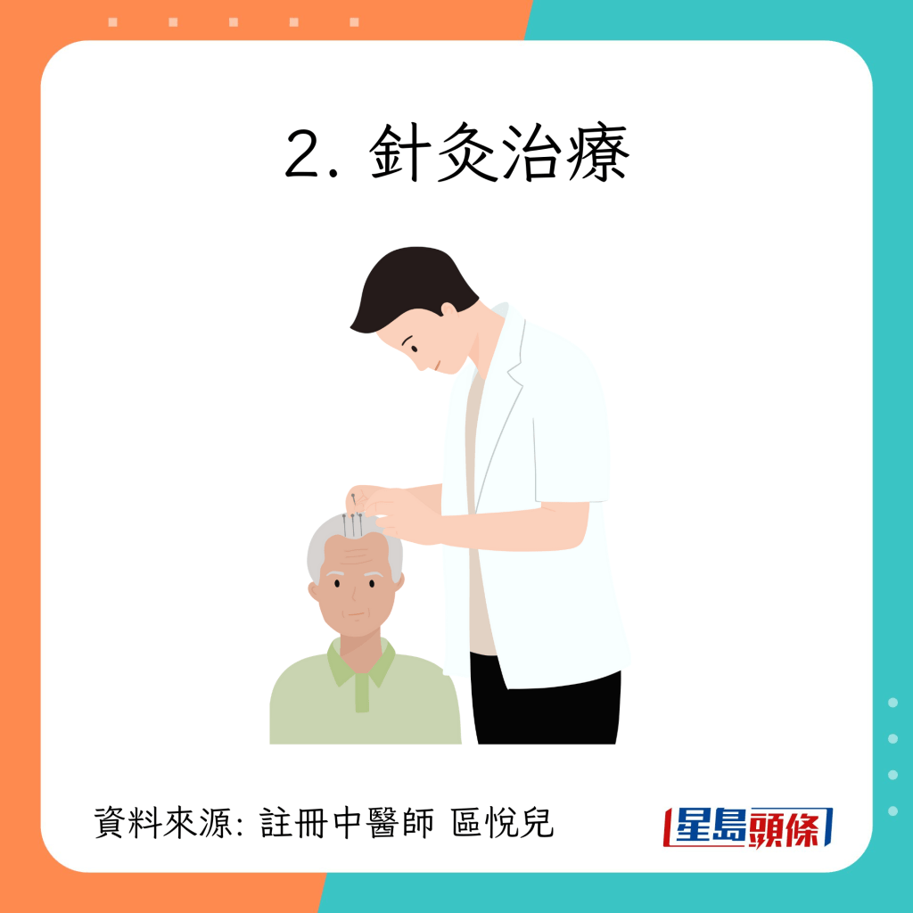 中醫2大生髮治療方案｜2. 針灸治療 