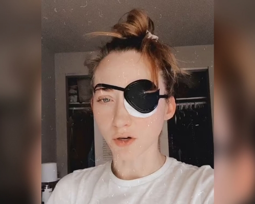 化萬聖節裝戴有色隱形眼鏡,女子拔除時竟扯下眼角膜外層險失明。網圖
