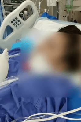 廣東29歲女打瘦臉針中毒入ICU。大象新聞 廣東29歲女打瘦臉針中毒入ICU。大象新聞