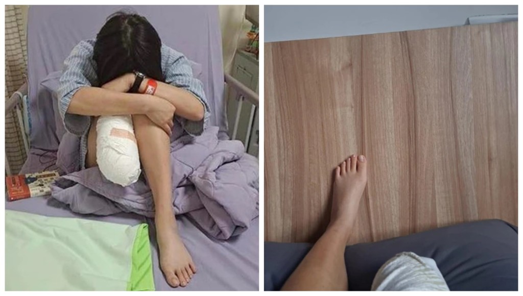 女員工的右腳已被截掉。互聯網圖片