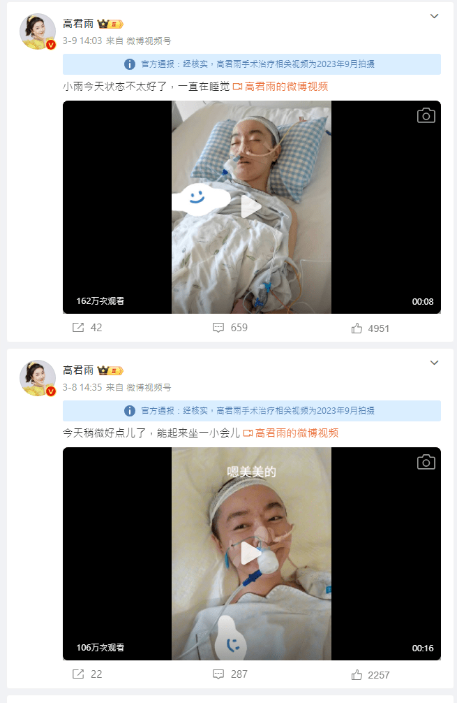高君雨的微博近日贴出一连串做手术的影片，更表示自己罹患罕见脑瘤。