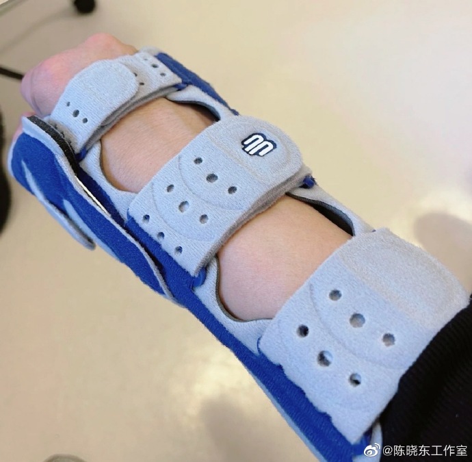 陳曉東不想做手術取骨,現戴護具休養待自動修復。