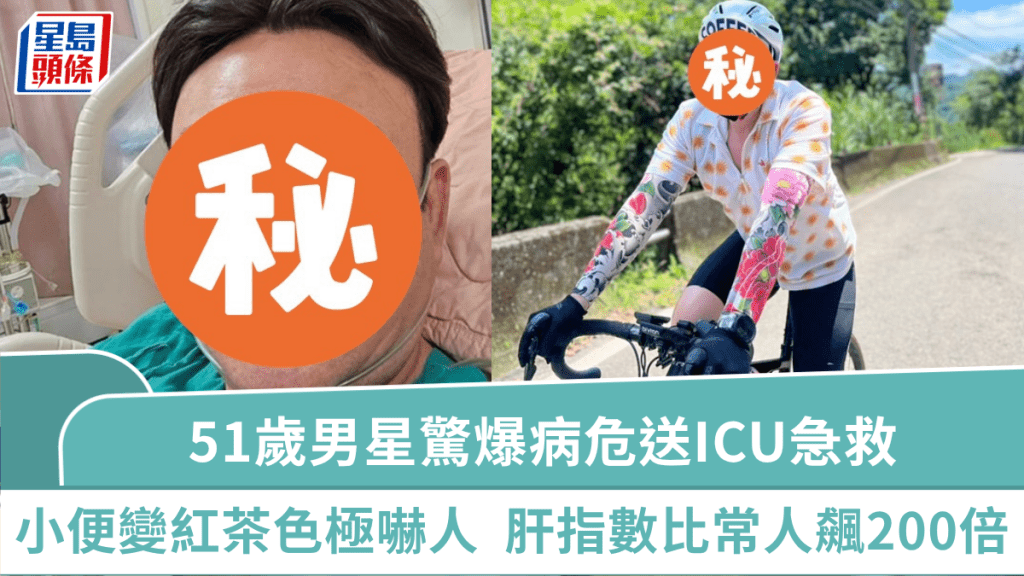 51歲男星驚爆病危送ICU急救  小便變紅茶色極嚇人  肝指數比常人飆200倍