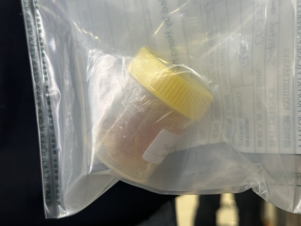男旅客体内藏毒，至今排出市值约170万元液态可卡因。梁国峰摄