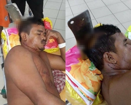 傷者淡定托頭送院。網上圖片