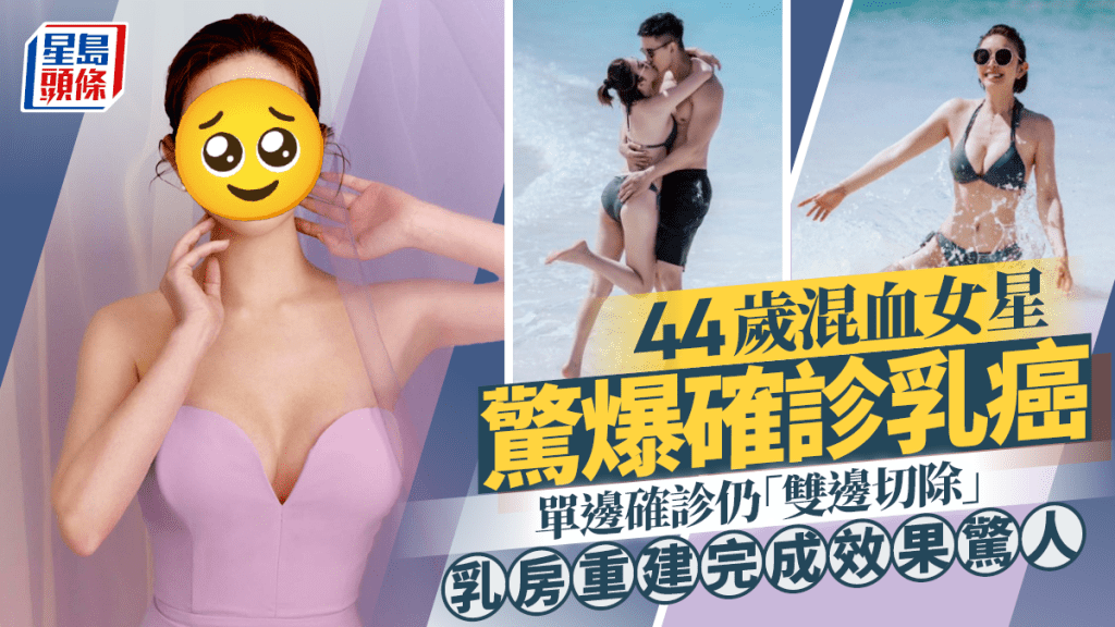 44歲混血女星驚爆確診乳癌  單邊確診仍「雙邊切除」 乳房重建完成效果驚人