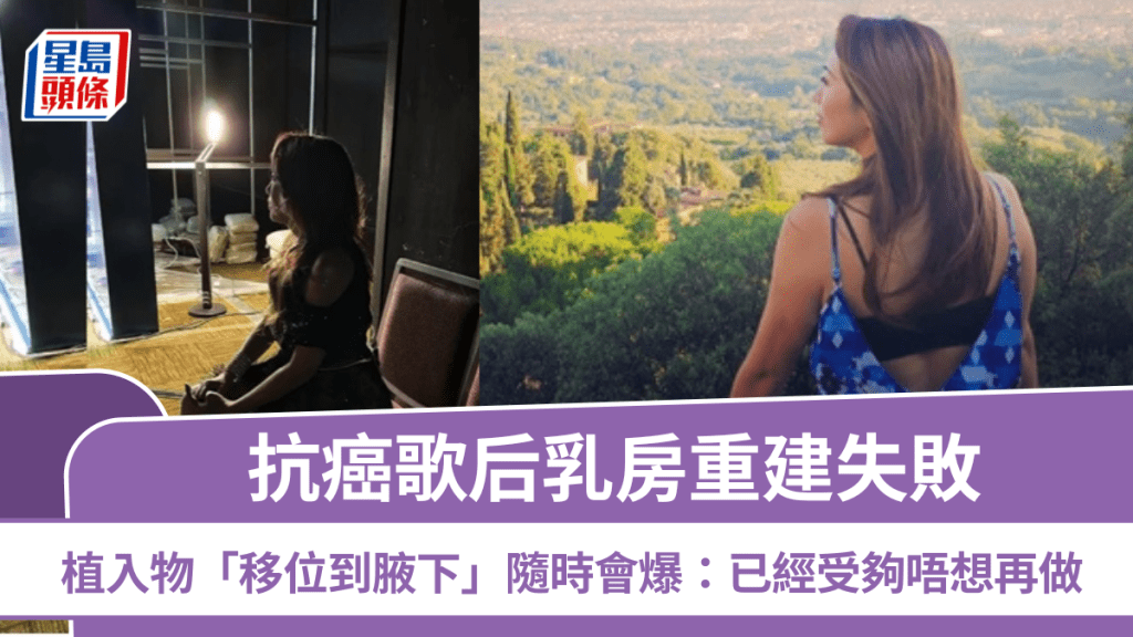 抗癌歌后豁達面對人生起跌 乳房重建失敗植入物「移位到腋下」隨時會爆：已經受夠唔想再做