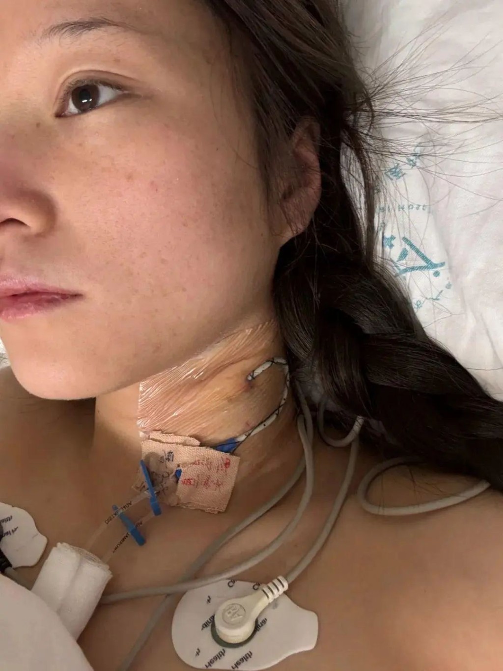 车祸发生后，白女士胸部以下高位截瘫。大象新闻