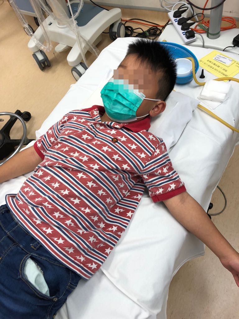 軒仔的左眼因被手指插傷，微絲血管爆裂。