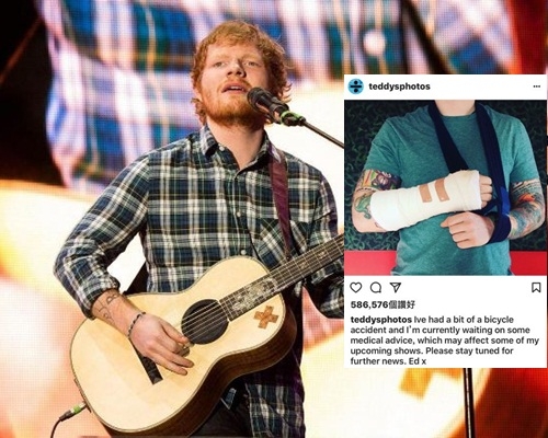 Ed Sheeran傷手暫難自彈自唱。