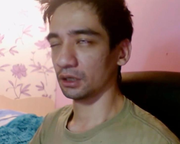 毒力很快發作。