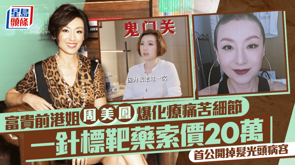 富貴前港姐周美鳳爆化療痛苦細節  一針標靶藥索價20萬  首公開掉髮光頭病容：只能苦中作樂
