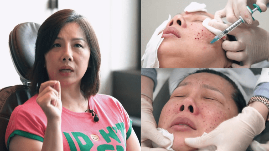 「御用師奶」黃梓瑋50針狂拮臉頰滲血  直擊痛到喊整容實錄  再豪擲12萬換自信笑容