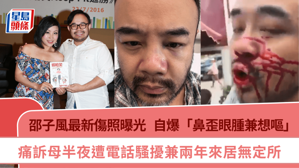邵子風最新傷照曝光 自爆「鼻歪眼腫兼想嘔」  痛訴母半夜遭電話騷擾兼兩年來居無定所