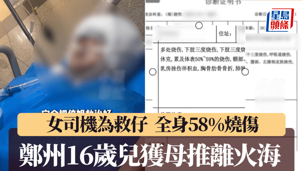 李女士為救兒子，未第一時間離開起火車輛，導致全身58%被燒傷。小莉幫忙