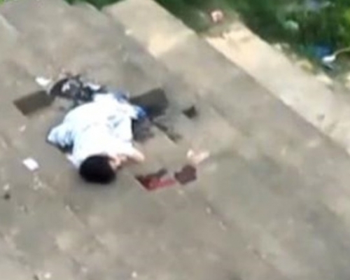 江西女子劉桃香失足跌落樓梯頭部受重創，導致腦死亡。（網圖）