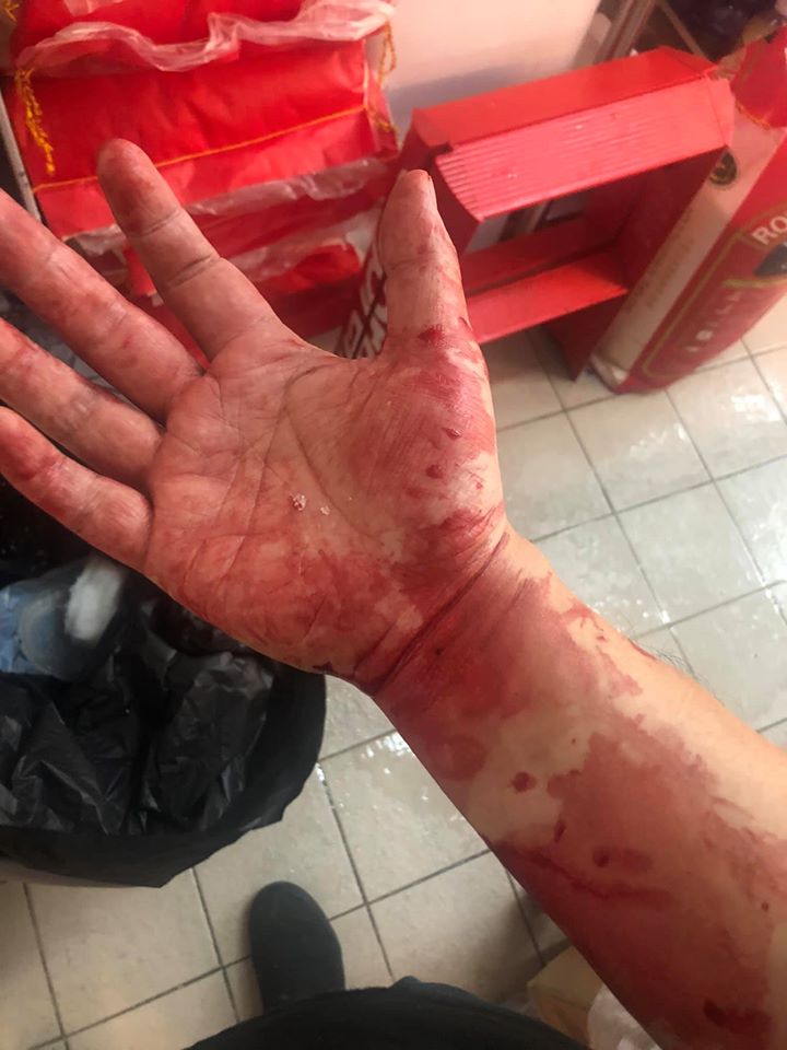 事主遇襲後手部受傷。 「水門泰式雞飯專門店」fb圖片