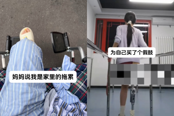 夏夏自己存錢買義肢。