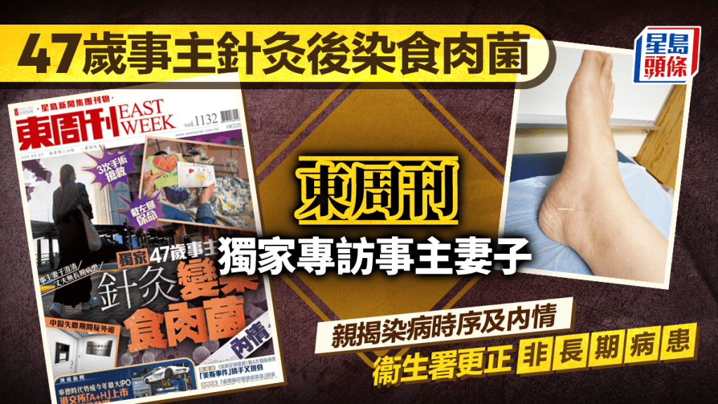 食肉菌︱47歲事主針炙後感染截肢 《東周刊》獨家專訪事主妻子揭內情 衞生署更正非長期病患
